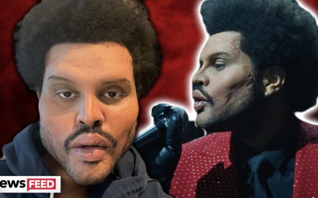 The Weeknd Explains His Extreme Look And Those Bandages
