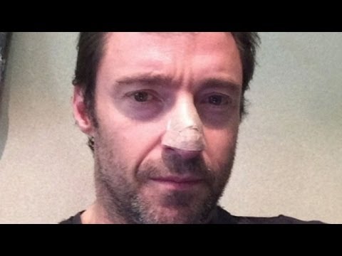 Hugh Jackman Continues To Urge You To Wear Sunscreen After Another Skin Biopsy