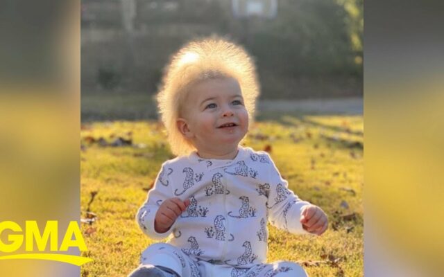 This Little Cutie Has “Uncontrollable Hair Syndrome”
