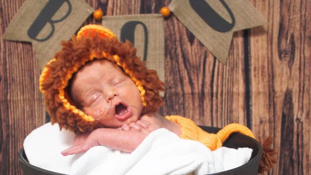 Norton Health Dresses Up NICU Babies In Adorable Costumes